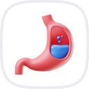 Gastric Sleeve Consultation