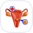 Ovarian Cyst Consultation