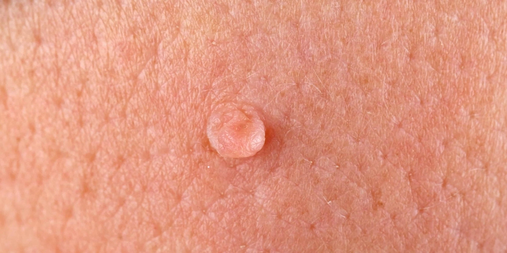 Featured Image