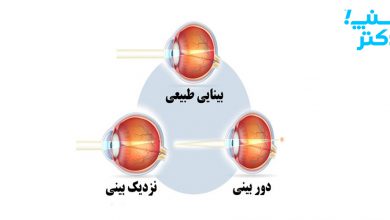 نزدیک بینی چشم و دوربینی چشم