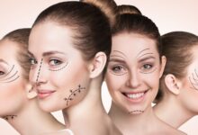 از لیپوساکشن صورت، مزایا و عوارض جانبی آن چه می‌دانید؟