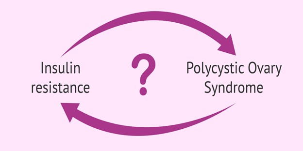 PCOS -سندرم تخمدان پلی کیستیک 