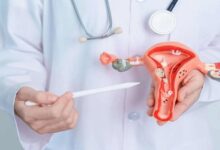 تاثیر تنبلی تخمدان روی بارداری