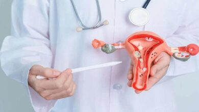 تاثیر تنبلی تخمدان روی بارداری