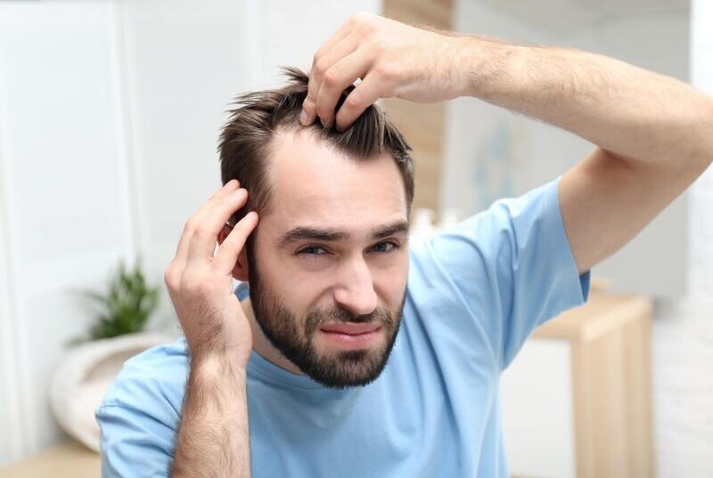 ریزش مو، از نشانه‌های کمبود ویتامین D