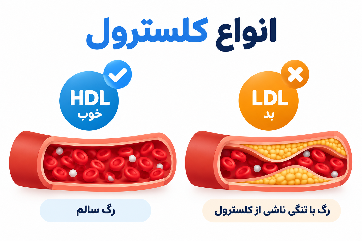 رژیم کتو چه تأثیری بر LDL، HDL و تریگلیسرید دارد؟