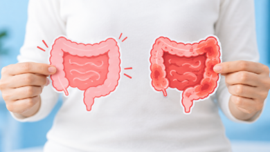 تفاوت IBS و IBD چیست؟