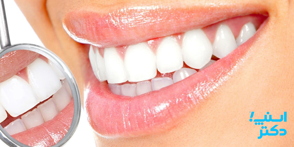 جلوگیری از زرد شدن دندان